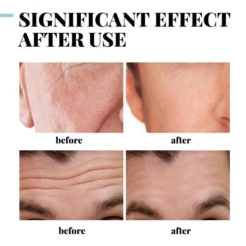 Collagen Anti Wrinkle Creams for Men